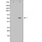 DF6187 at 1/100 staining Mouse muscle tissue by IHC-P. The sample was formaldehyde fixed and a heat mediated antigen retrieval step in citrate buffer was performed. The sample was then blocked and incubated with the antibody for 1.5 hours at 22¡ãC. An HRP conjugated goat anti-rabbit antibody was used as the secondary