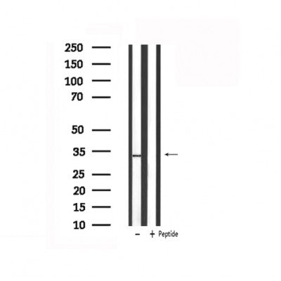 DF6192 at 1/100 staining Mouse kidney tissue by IHC-P. The sample was formaldehyde fixed and a heat mediated antigen retrieval step in citrate buffer was performed. The sample was then blocked and incubated with the antibody for 1.5 hours at 22¡ãC. An HRP conjugated goat anti-rabbit antibody was used as the secondary