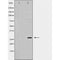 DF6195 at 1/100 staining Mouse brain tissue by IHC-P. The sample was formaldehyde fixed and a heat mediated antigen retrieval step in citrate buffer was performed. The sample was then blocked and incubated with the antibody for 1.5 hours at 22¡ãC. An HRP conjugated goat anti-rabbit antibody was used as the secondary