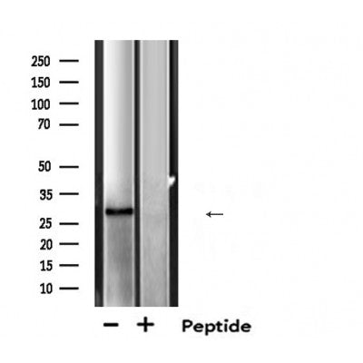 DF6197 at 1/100 staining Mouse colon tissue by IHC-P. The sample was formaldehyde fixed and a heat mediated antigen retrieval step in citrate buffer was performed. The sample was then blocked and incubated with the antibody for 1.5 hours at 22¡ãC. An HRP conjugated goat anti-rabbit antibody was used as the secondary