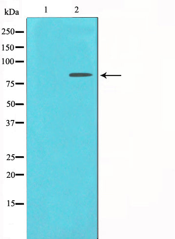 Western blot analysis on HeLa cell lysate using Catenin-gamma Antibody,The lane on the left is treated with the antigen-specific peptide.