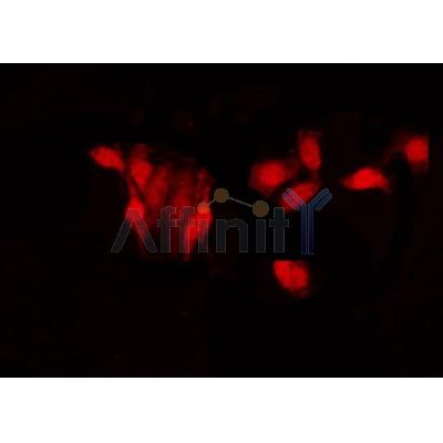 AF0124 staining HeLa by IF/ICC. The sample were fixed with PFA and permeabilized in 0.1% Triton X-100,then blocked in 10% serum for 45 minutes at 25¡ãC. The primary antibody was diluted at 1/200 and incubated with the sample for 1 hour at 37¡ãC. An  Alexa Fluor 594 conjugated goat anti-rabbit IgG (H+L) Ab, diluted at 1/600, was used as the secondary antibod