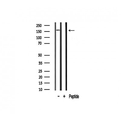 Western blot analysis on mouse lung lysate using RON Antibody.The lane on the right is treated with the antigen-specific peptide.