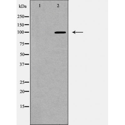 DF6201 at 1/100 staining Mouse brain tissue by IHC-P. The sample was formaldehyde fixed and a heat mediated antigen retrieval step in citrate buffer was performed. The sample was then blocked and incubated with the antibody for 1.5 hours at 22¡ãC. An HRP conjugated goat anti-rabbit antibody was used as the secondary