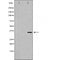 DF6204 at 1/100 staining Mouse spleen tissue by IHC-P. The sample was formaldehyde fixed and a heat mediated antigen retrieval step in citrate buffer was performed. The sample was then blocked and incubated with the antibody for 1.5 hours at 22¡ãC. An HRP conjugated goat anti-rabbit antibody was used as the secondary