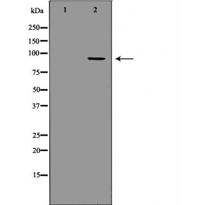 DF6205 at 1/100 staining Mouse brain tissue by IHC-P. The sample was formaldehyde fixed and a heat mediated antigen retrieval step in citrate buffer was performed. The sample was then blocked and incubated with the antibody for 1.5 hours at 22¡ãC. An HRP conjugated goat anti-rabbit antibody was used as the secondary