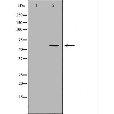 DF6208 at 1/100 staining Mouse liver tissue by IHC-P. The sample was formaldehyde fixed and a heat mediated antigen retrieval step in citrate buffer was performed. The sample was then blocked and incubated with the antibody for 1.5 hours at 22¡ãC. An HRP conjugated goat anti-rabbit antibody was used as the secondary