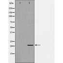 DF6210 at 1/100 staining Human lung tissue by IHC-P. The sample was formaldehyde fixed and a heat mediated antigen retrieval step in citrate buffer was performed. The sample was then blocked and incubated with the antibody for 1.5 hours at 22¡ãC. An HRP conjugated goat anti-rabbit antibody was used as the secondary