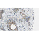 DF6214 staining HepG2 by IF/ICC. The sample were fixed with PFA and permeabilized in 0.1% Triton X-100,then blocked in 10% serum for 45 minutes at 25¡ãC. The primary antibody was diluted at 1/200 and incubated with the sample for 1 hour at 37¡ãC. An  Alexa Fluor 594 conjugated goat anti-rabbit IgG (H+L) Ab, diluted at 1/600, was used as the secondary antibod