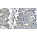 Western blot analysis of extracts from B16F10, using ARPC1A Antibody. The lane on the left was treated with blocking peptide.
