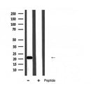 DF6216 at 1/100 staining Mouse brain tissue by IHC-P. The sample was formaldehyde fixed and a heat mediated antigen retrieval step in citrate buffer was performed. The sample was then blocked and incubated with the antibody for 1.5 hours at 22¡ãC. An HRP conjugated goat anti-rabbit antibody was used as the secondary