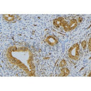 Western blot analysis of extracts from mouse testis, using RNASE12 Antibody. The lane on the right was treated with blocking peptide.
