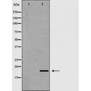 DF6218 at 1/100 staining Human uterus tissue by IHC-P. The sample was formaldehyde fixed and a heat mediated antigen retrieval step in citrate buffer was performed. The sample was then blocked and incubated with the antibody for 1.5 hours at 22¡ãC. An HRP conjugated goat anti-rabbit antibody was used as the secondary