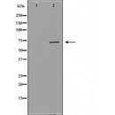 DF6224 at 1/100 staining Human gastric tissue by IHC-P. The sample was formaldehyde fixed and a heat mediated antigen retrieval step in citrate buffer was performed. The sample was then blocked and incubated with the antibody for 1.5 hours at 22¡ãC. An HRP conjugated goat anti-rabbit antibody was used as the secondary