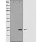 DF6226 at 1/100 staining Human Melanoma tissue by IHC-P. The sample was formaldehyde fixed and a heat mediated antigen retrieval step in citrate buffer was performed. The sample was then blocked and incubated with the antibody for 1.5 hours at 22¡ãC. An HRP conjugated goat anti-rabbit antibody was used as the secondary