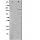 DF6228 at 1/100 staining Human prostate tissue by IHC-P. The sample was formaldehyde fixed and a heat mediated antigen retrieval step in citrate buffer was performed. The sample was then blocked and incubated with the antibody for 1.5 hours at 22¡ãC. An HRP conjugated goat anti-rabbit antibody was used as the secondary