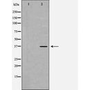 DF6233 at 1/100 staining Rat liver tissue by IHC-P. The sample was formaldehyde fixed and a heat mediated antigen retrieval step in citrate buffer was performed. The sample was then blocked and incubated with the antibody for 1.5 hours at 22¡ãC. An HRP conjugated goat anti-rabbit antibody was used as the secondary