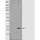 DF6234 at 1/100 staining Human uterus tissue by IHC-P. The sample was formaldehyde fixed and a heat mediated antigen retrieval step in citrate buffer was performed. The sample was then blocked and incubated with the antibody for 1.5 hours at 22¡ãC. An HRP conjugated goat anti-rabbit antibody was used as the secondary
