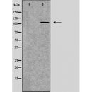 DF6240 at 1/100 staining Mouse liver tissue by IHC-P. The sample was formaldehyde fixed and a heat mediated antigen retrieval step in citrate buffer was performed. The sample was then blocked and incubated with the antibody for 1.5 hours at 22¡ãC. An HRP conjugated goat anti-rabbit antibody was used as the secondary