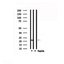 DF6241 at 1/100 staining Mouse brain tissue by IHC-P. The sample was formaldehyde fixed and a heat mediated antigen retrieval step in citrate buffer was performed. The sample was then blocked and incubated with the antibody for 1.5 hours at 22¡ãC. An HRP conjugated goat anti-rabbit antibody was used as the secondary