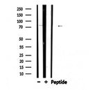 DF6247 at 1/100 staining Human prostate tissue by IHC-P. The sample was formaldehyde fixed and a heat mediated antigen retrieval step in citrate buffer was performed. The sample was then blocked and incubated with the antibody for 1.5 hours at 22¡ãC. An HRP conjugated goat anti-rabbit antibody was used as the secondary