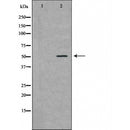 DF6248 at 1/100 staining Mouse colon tissue by IHC-P. The sample was formaldehyde fixed and a heat mediated antigen retrieval step in citrate buffer was performed. The sample was then blocked and incubated with the antibody for 1.5 hours at 22¡ãC. An HRP conjugated goat anti-rabbit antibody was used as the secondary