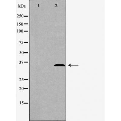 DF6253 at 1/100 staining Mouse spleen tissue by IHC-P. The sample was formaldehyde fixed and a heat mediated antigen retrieval step in citrate buffer was performed. The sample was then blocked and incubated with the antibody for 1.5 hours at 22¡ãC. An HRP conjugated goat anti-rabbit antibody was used as the secondary