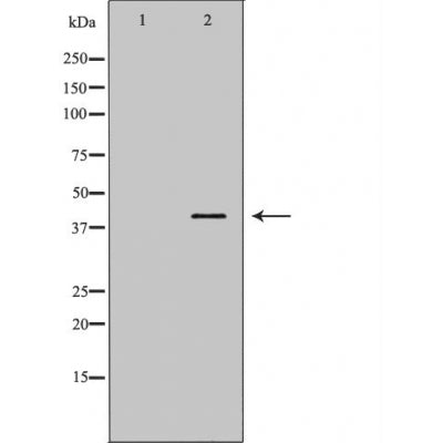 Western blot analysis of Hela  using ANXA1 antibody. The lane on the left is treated with the antigen-specific peptide.