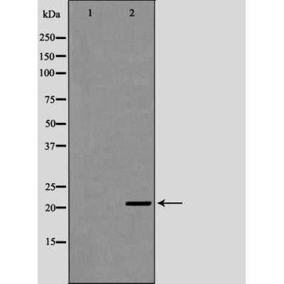 DF6255 at 1/100 staining Mouse brain tissue by IHC-P. The sample was formaldehyde fixed and a heat mediated antigen retrieval step in citrate buffer was performed. The sample was then blocked and incubated with the antibody for 1.5 hours at 22¡ãC. An HRP conjugated goat anti-rabbit antibody was used as the secondary
