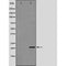 DF6255 at 1/100 staining Mouse brain tissue by IHC-P. The sample was formaldehyde fixed and a heat mediated antigen retrieval step in citrate buffer was performed. The sample was then blocked and incubated with the antibody for 1.5 hours at 22¡ãC. An HRP conjugated goat anti-rabbit antibody was used as the secondary