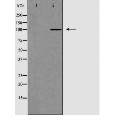 DF6257 at 1/100 staining Mouse colon tissue by IHC-P. The sample was formaldehyde fixed and a heat mediated antigen retrieval step in citrate buffer was performed. The sample was then blocked and incubated with the antibody for 1.5 hours at 22¡ãC. An HRP conjugated goat anti-rabbit antibody was used as the secondary