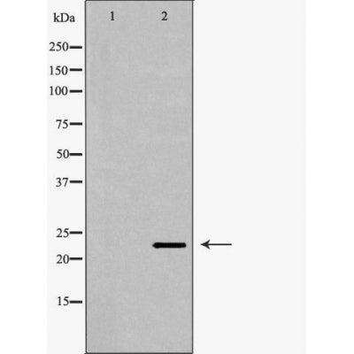 DF6260 at 1/100 staining Mouse testis tissue by IHC-P. The sample was formaldehyde fixed and a heat mediated antigen retrieval step in citrate buffer was performed. The sample was then blocked and incubated with the antibody for 1.5 hours at 22¡ãC. An HRP conjugated goat anti-rabbit antibody was used as the secondary