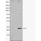 DF6260 at 1/100 staining Mouse testis tissue by IHC-P. The sample was formaldehyde fixed and a heat mediated antigen retrieval step in citrate buffer was performed. The sample was then blocked and incubated with the antibody for 1.5 hours at 22¡ãC. An HRP conjugated goat anti-rabbit antibody was used as the secondary