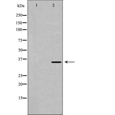DF6261 at 1/100 staining Mouse testis tissue by IHC-P. The sample was formaldehyde fixed and a heat mediated antigen retrieval step in citrate buffer was performed. The sample was then blocked and incubated with the antibody for 1.5 hours at 22¡ãC. An HRP conjugated goat anti-rabbit antibody was used as the secondary