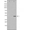 DF6261 at 1/100 staining Mouse testis tissue by IHC-P. The sample was formaldehyde fixed and a heat mediated antigen retrieval step in citrate buffer was performed. The sample was then blocked and incubated with the antibody for 1.5 hours at 22¡ãC. An HRP conjugated goat anti-rabbit antibody was used as the secondary