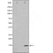 DF6262 at 1/100 staining Mouse muscle tissue by IHC-P. The sample was formaldehyde fixed and a heat mediated antigen retrieval step in citrate buffer was performed. The sample was then blocked and incubated with the antibody for 1.5 hours at 22¡ãC. An HRP conjugated goat anti-rabbit antibody was used as the secondary