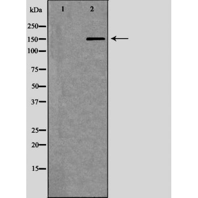 DF6263 at 1/100 staining Human gastric tissue by IHC-P. The sample was formaldehyde fixed and a heat mediated antigen retrieval step in citrate buffer was performed. The sample was then blocked and incubated with the antibody for 1.5 hours at 22¡ãC. An HRP conjugated goat anti-rabbit antibody was used as the secondary