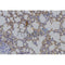 Western blot analysis of extracts from HepG2, using AMACR  Antibody. The lane on the left was treated with blocking peptide.