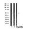 DF6268 at 1/100 staining Human brain cancer tissue by IHC-P. The sample was formaldehyde fixed and a heat mediated antigen retrieval step in citrate buffer was performed. The sample was then blocked and incubated with the antibody for 1.5 hours at 22¡ãC. An HRP conjugated goat anti-rabbit antibody was used as the secondary