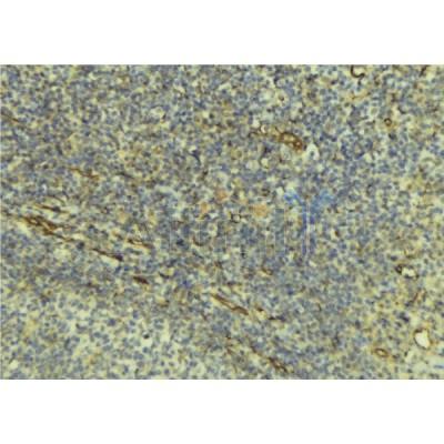 Western blot analysis of extracts from rat muscle, using TNFRSF10C  Antibody. Lane 1 was treated with the antigen-specific peptide.