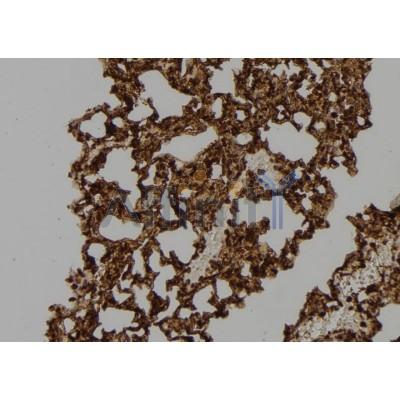 Western blot analysis of extracts from Mouse  spleen, using RAC2 Antibody. The lane on the left was treated with blocking peptide.