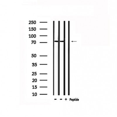 Western blot analysis of extracts from mouse brain, using RALBP1 Antibody. Lane 1 was treated with the antigen-specific peptide.