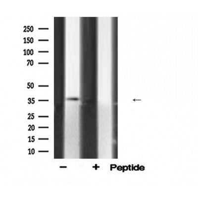 DF6276 at 1/100 staining Rat brain tissue by IHC-P. The sample was formaldehyde fixed and a heat mediated antigen retrieval step in citrate buffer was performed. The sample was then blocked and incubated with the antibody for 1.5 hours at 22¡ãC. An HRP conjugated goat anti-rabbit antibody was used as the secondary