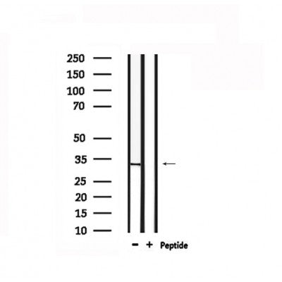 DF6279 at 1/100 staining Rat brain tissue by IHC-P. The sample was formaldehyde fixed and a heat mediated antigen retrieval step in citrate buffer was performed. The sample was then blocked and incubated with the antibody for 1.5 hours at 22¡ãC. An HRP conjugated goat anti-rabbit antibody was used as the secondary