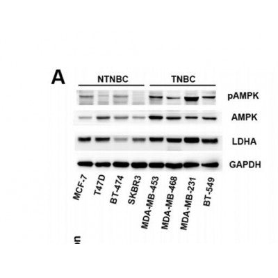 Western blot analysis of extracts from various samples, using LDHA  Antibody.
 Lane 1: Hela treated with blocking peptide;
 Lane 2: Hela;
 Lane 3: HepG2.