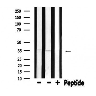 DF6281 at 1/100 staining Mouse brain tissue by IHC-P. The sample was formaldehyde fixed and a heat mediated antigen retrieval step in citrate buffer was performed. The sample was then blocked and incubated with the antibody for 1.5 hours at 22¡ãC. An HRP conjugated goat anti-rabbit antibody was used as the secondary