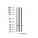 Western blot analysis of extracts from Hela, using RAB7A Antibody. Lane 1 was treated with the antigen-specific peptide.