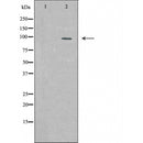 DF6290 at 1/100 staining Mouse colon tissue by IHC-P. The sample was formaldehyde fixed and a heat mediated antigen retrieval step in citrate buffer was performed. The sample was then blocked and incubated with the antibody for 1.5 hours at 22¡ãC. An HRP conjugated goat anti-rabbit antibody was used as the secondary