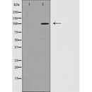 DF6294 at 1/100 staining Human prostate tissue by IHC-P. The sample was formaldehyde fixed and a heat mediated antigen retrieval step in citrate buffer was performed. The sample was then blocked and incubated with the antibody for 1.5 hours at 22¡ãC. An HRP conjugated goat anti-rabbit antibody was used as the secondary