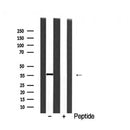 DF6296 at 1/100 staining Rat kidney tissue by IHC-P. The sample was formaldehyde fixed and a heat mediated antigen retrieval step in citrate buffer was performed. The sample was then blocked and incubated with the antibody for 1.5 hours at 22¡ãC. An HRP conjugated goat anti-rabbit antibody was used as the secondary